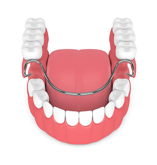 illustration of dentures