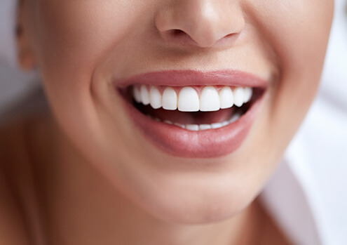 closeup of a bright, white smile