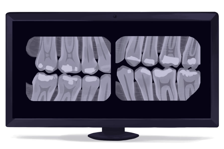 Monitor shows dental X-rays imaging