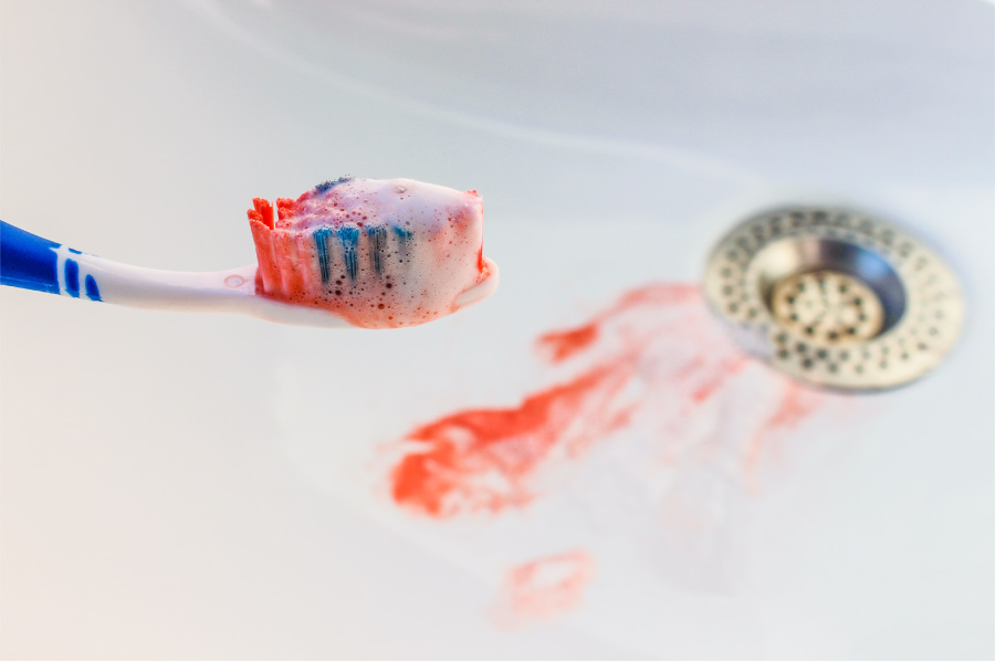 closeup of a toothbrush with blood on its bristles over a sink with blood in it due to bleeding gums